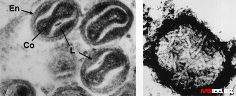 Nguyên nhân gây bệnh thủy đậu cho gà chọi thường do virus Fowlpox