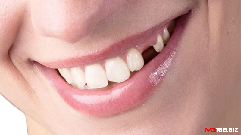Giấc mơ thấy rụng răng có nhiều ý nghĩa về sự cân bằng và ổn định