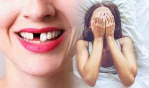 Nằm mơ thấy rụng răng điềm báo gì? Tốt hay xấu? Đánh con gì?